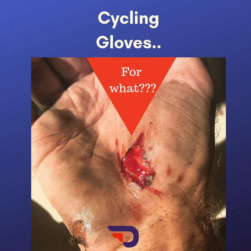 TO GLOVE OR NOT TO GLOVE...